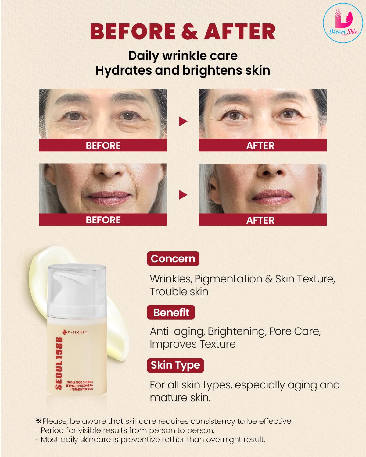 SEOUL 1988 Cream Retinal Liposome 1% + Fermented Rice [50ml] 